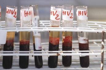 Aids, scoperti ‘codici’ del sistema immunitario per sospendere le cure
