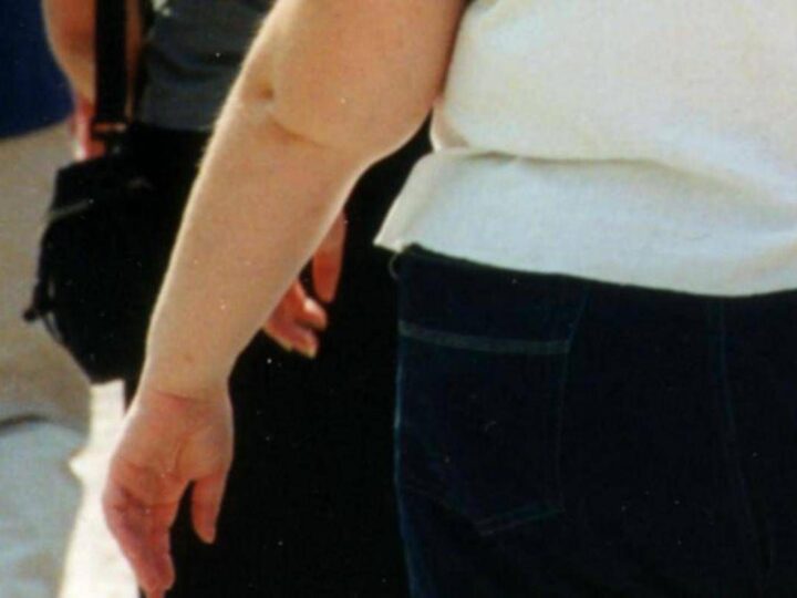 Salute: allerta endocrinologi, obesità triplicata in donne e raddoppiata in uomini