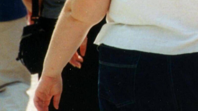 Salute: allerta endocrinologi, obesità triplicata in donne e raddoppiata in uomini