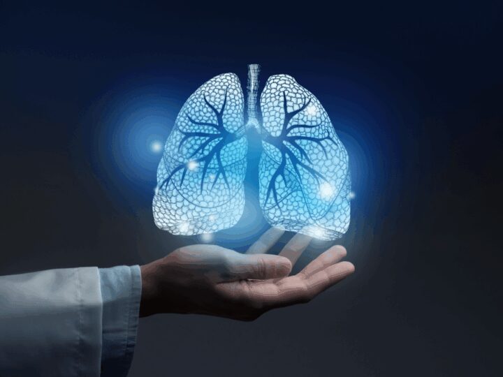 Tumori, Fondazione Fonicap: “Lung unit per tutti i pazienti con cancro polmone”