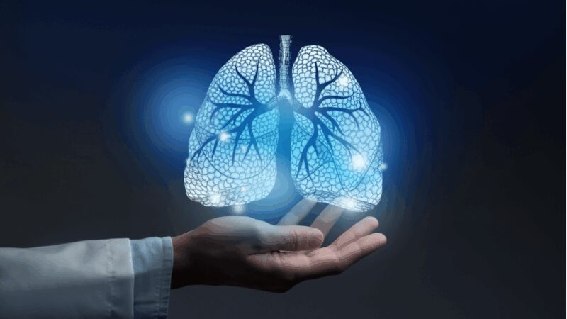 Tumori, Fondazione Fonicap: “Lung unit per tutti i pazienti con cancro polmone”