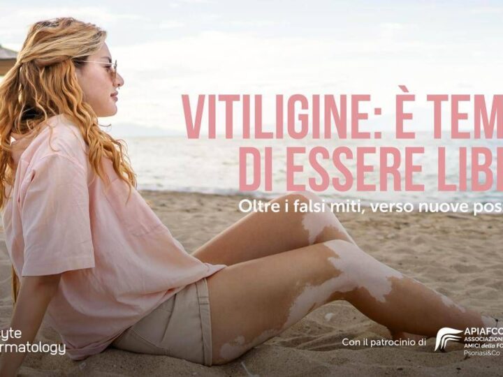 Salute, Giornata vitiligine: al via campagna ‘Oltre falsi miti verso nuove possibilità’