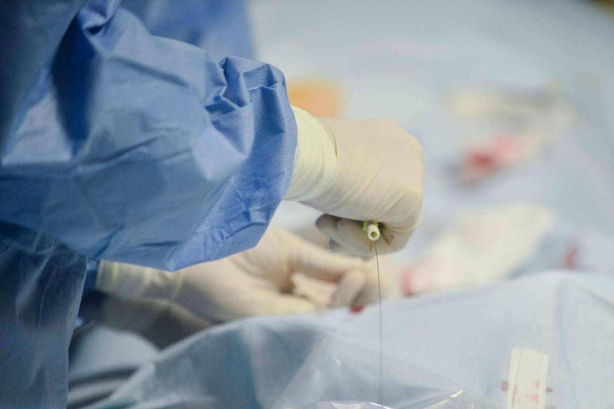 ‘Miracolato’ tre volte: a 85 anni supera terza rottura aorta con complesso intervento